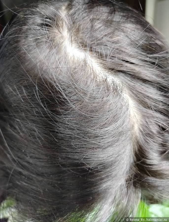 Фото: Прикорневая зона после шампуня Growth & Recovery