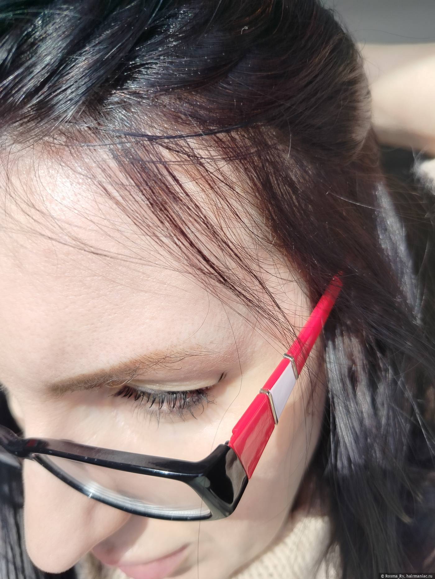 Фото: Зарастающие залысины на висках, фото 2