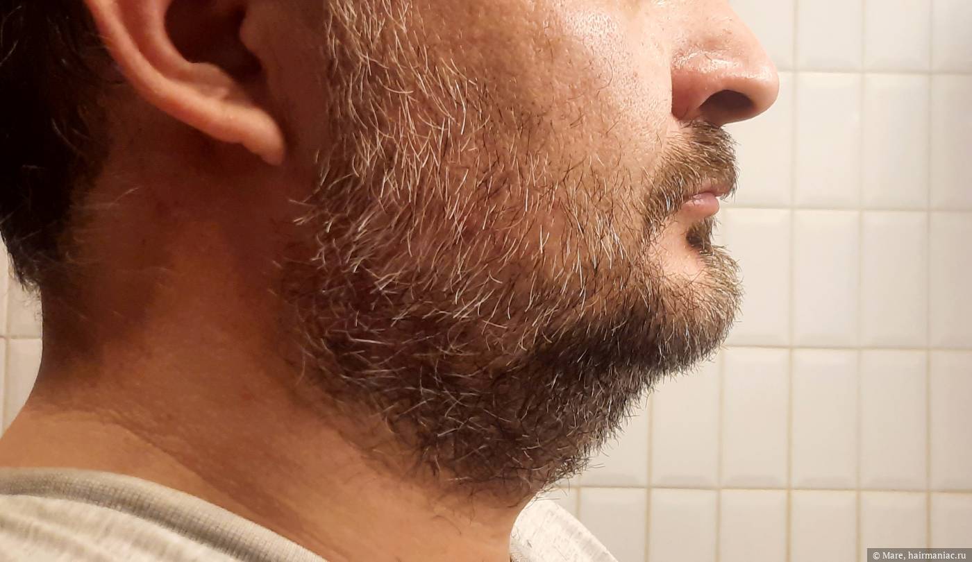 Фото: После стрижки с насадкой 9 мм