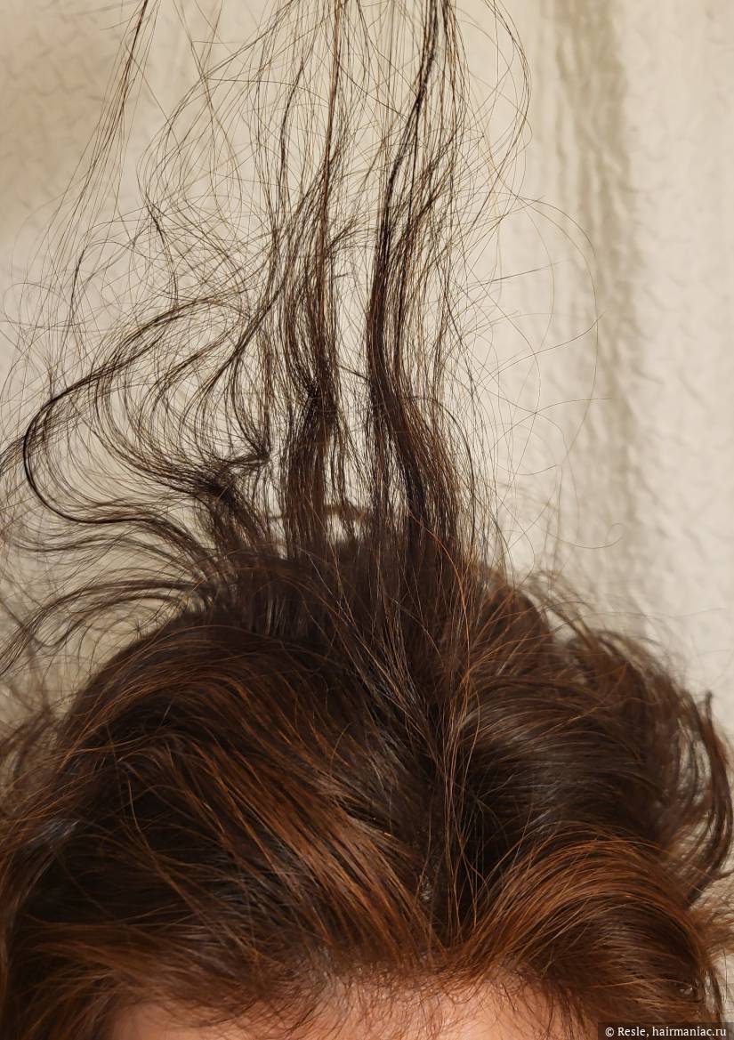 Фото: Волосы на теменной зоне