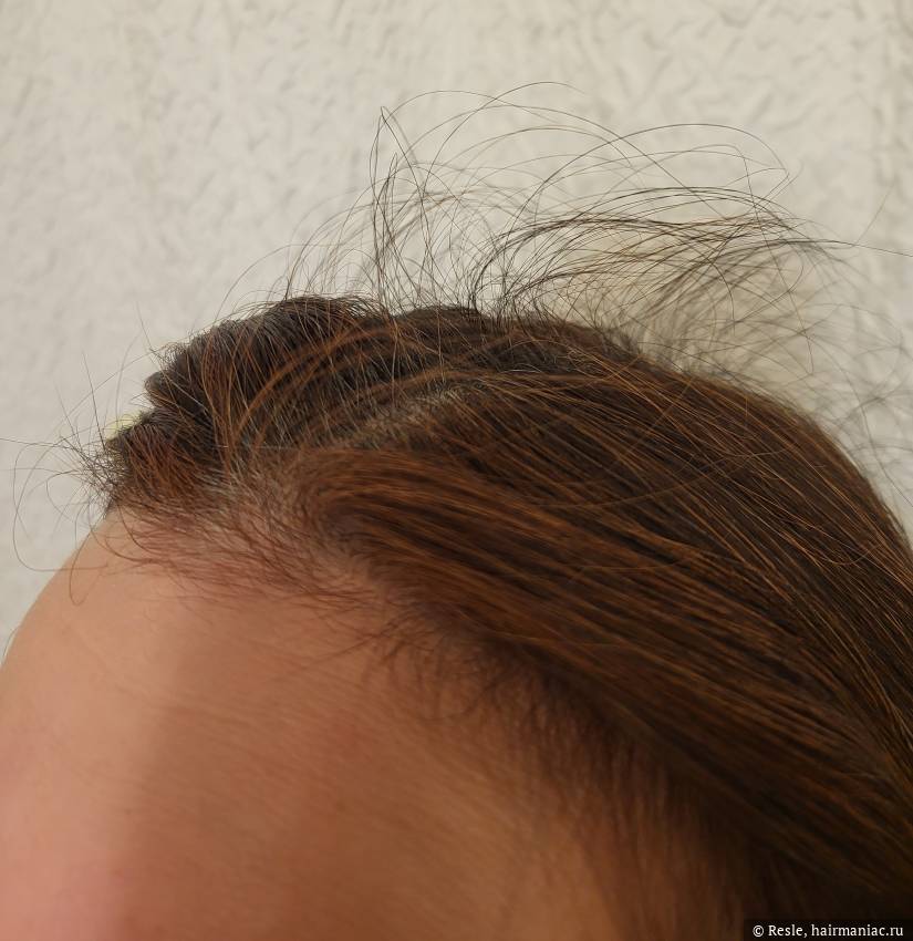 Фото: Новые волосы 4-5 см