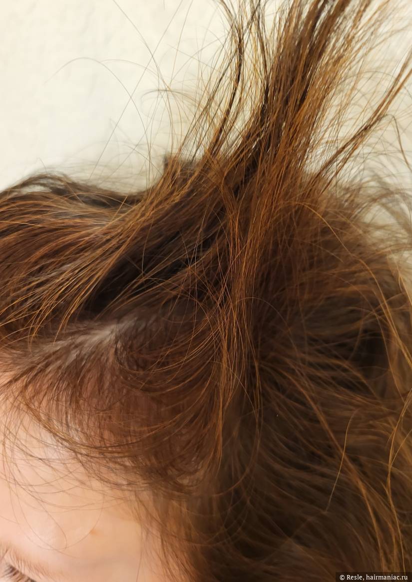 Фото: Волосы на височной зоне