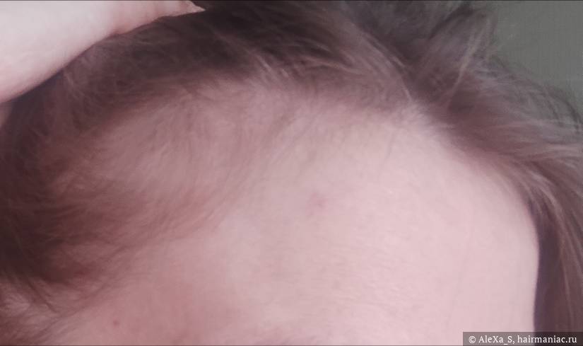 Фото: Височная часть справа