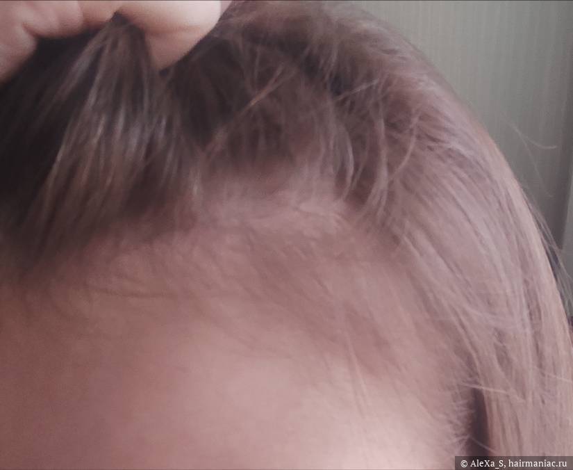 Фото: Височная часть слева