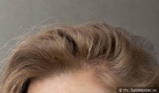 Фото: Объем у корней