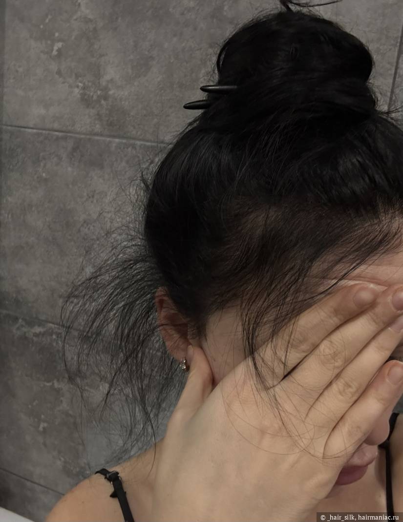 Результат стимуляции роста волос Фото: Результат стимуляции роста волос