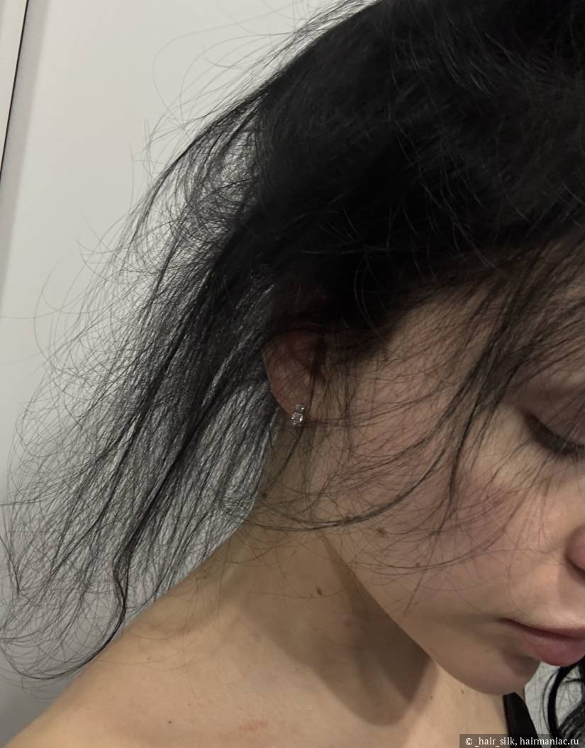 Фото: Результат стимуляции роста волос