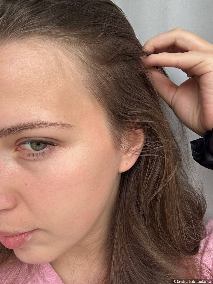 Фото: левый висок ноябрь