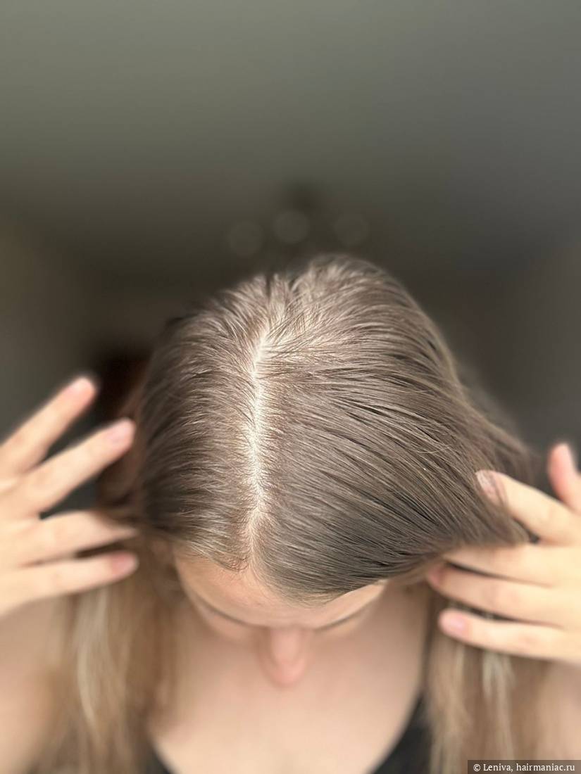 Фото: грязный пробор сентябрь