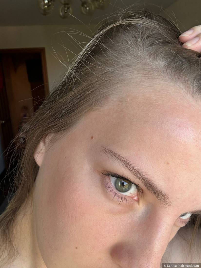 Фото: правый висок сентябрь