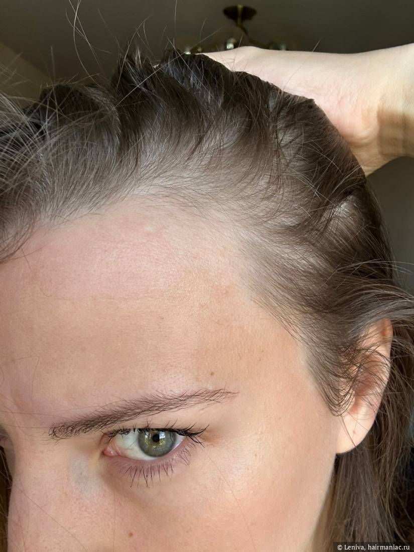 Фото: левый висок сентябрь