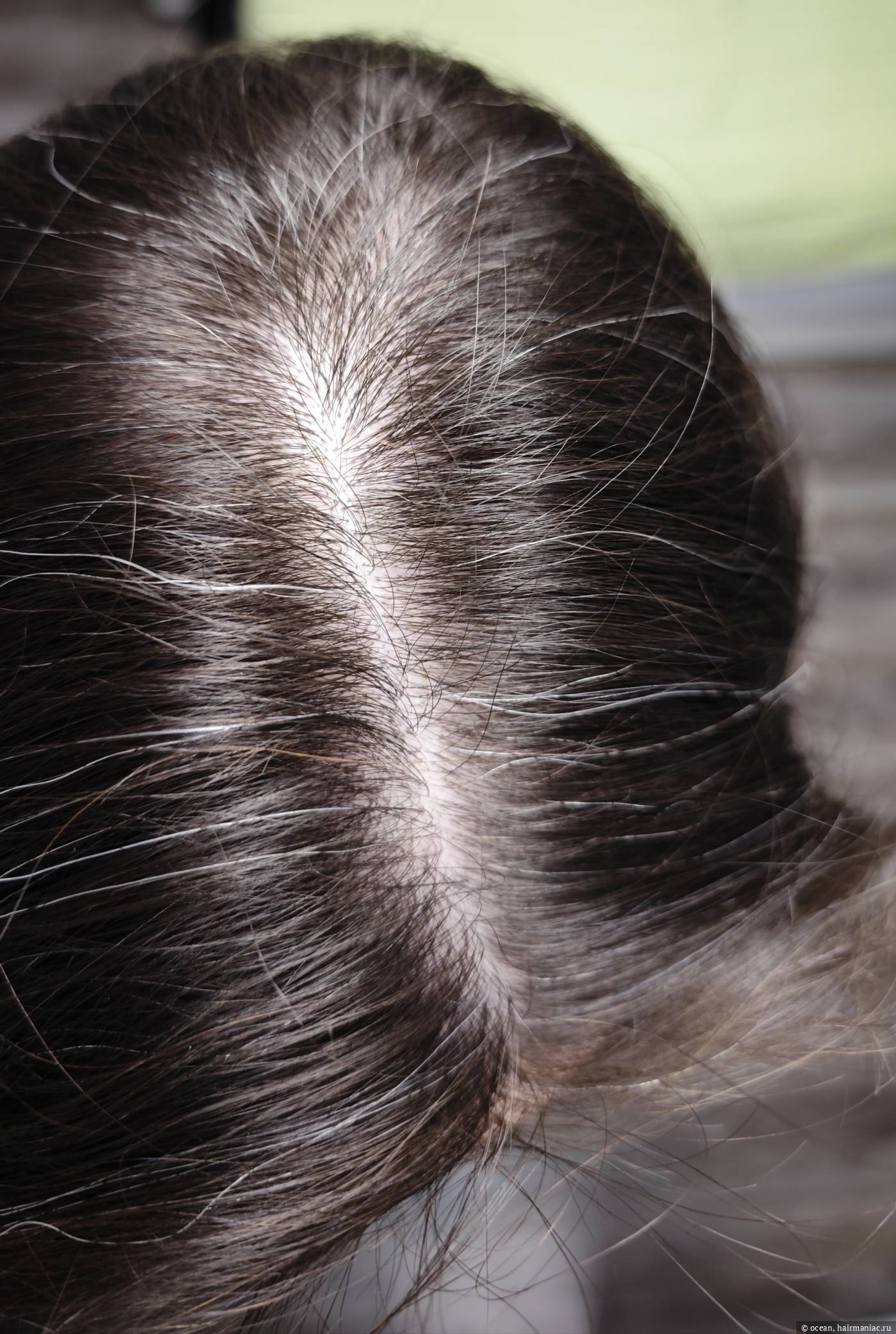 Фото: Пробор - если делать две косички или два хвоста, его ещё сильнее растягивает. Очевидно, но неприятно